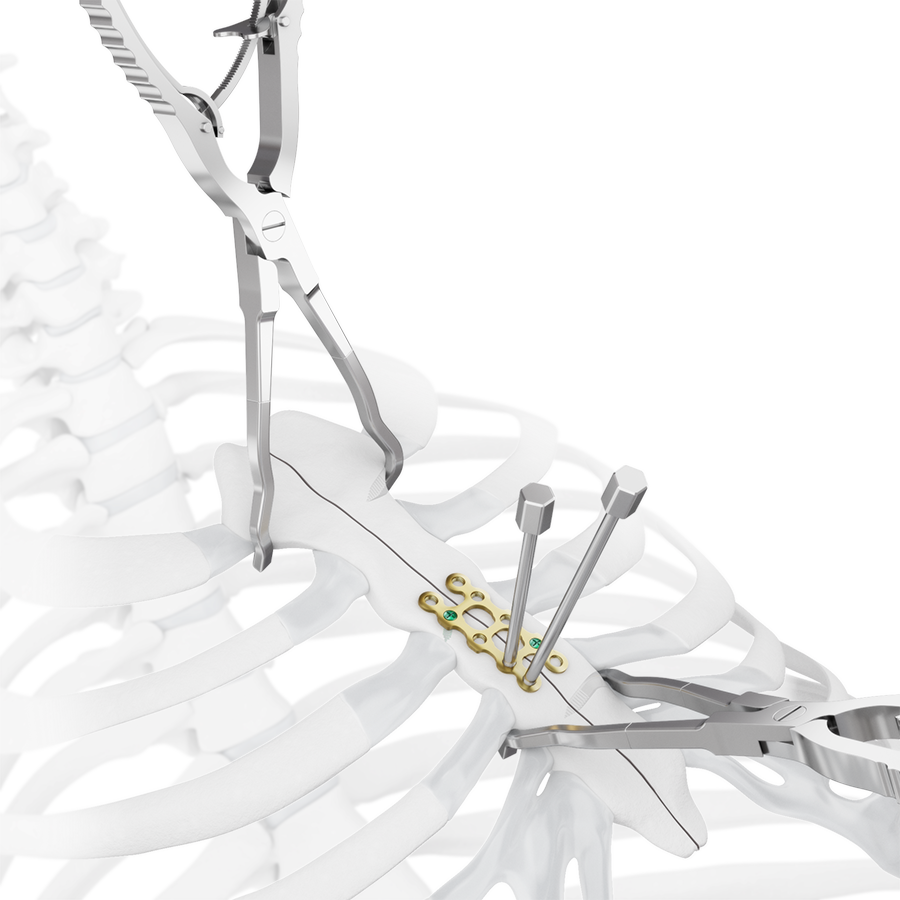 MatrixSTERNUM™ Instruments_in situ benders