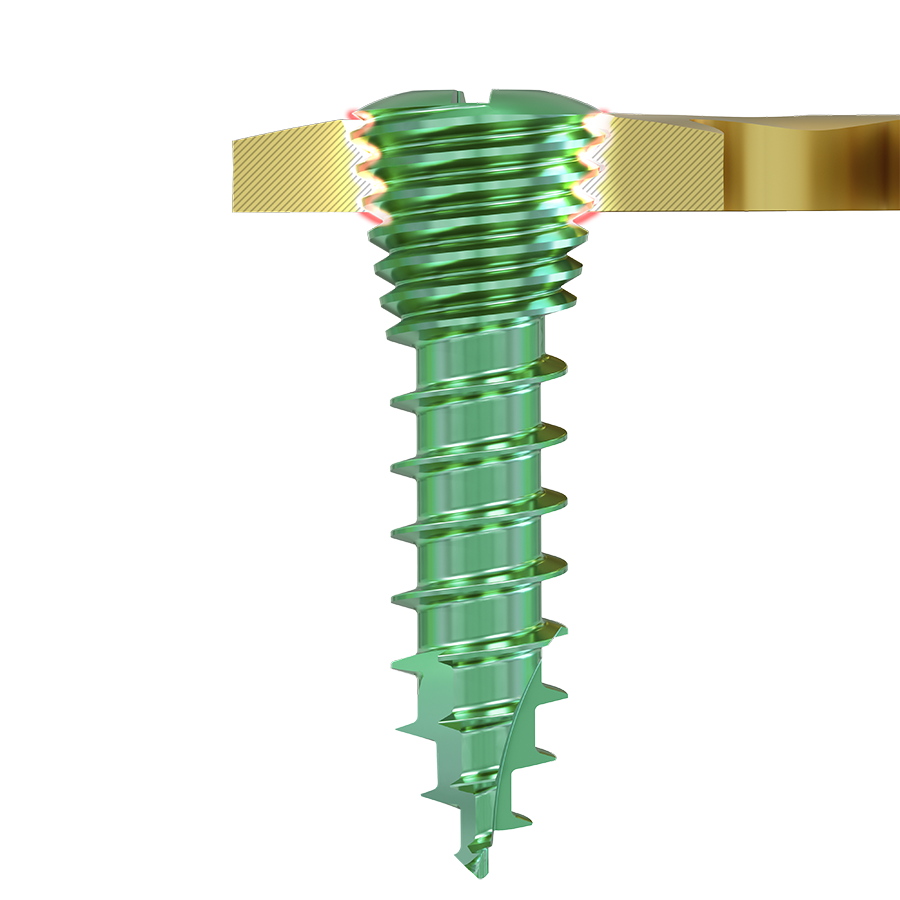 MatrixSTERNUM Screw