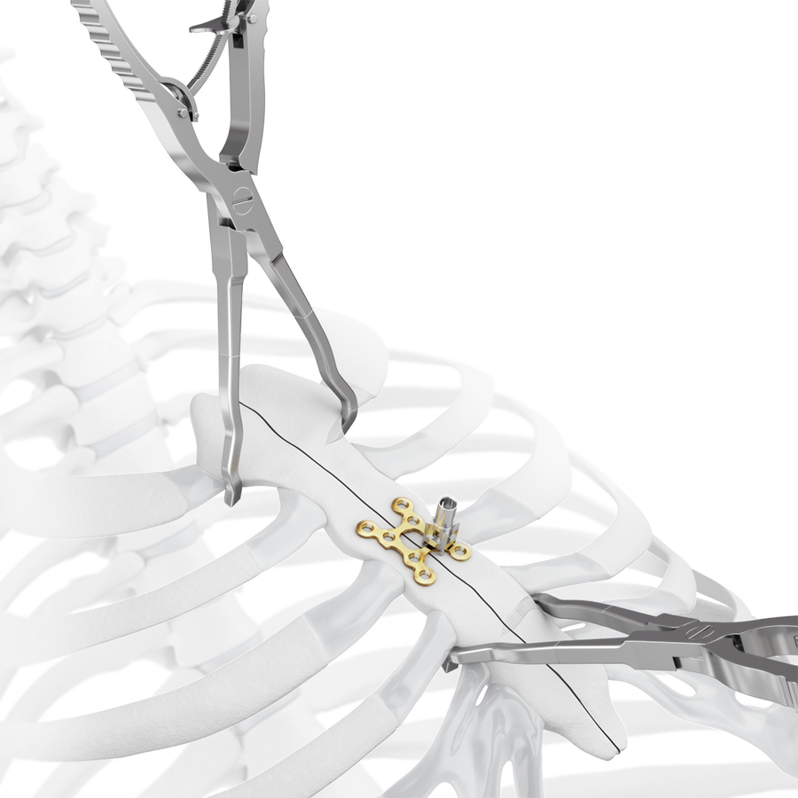 Sternal Reduction Forceps