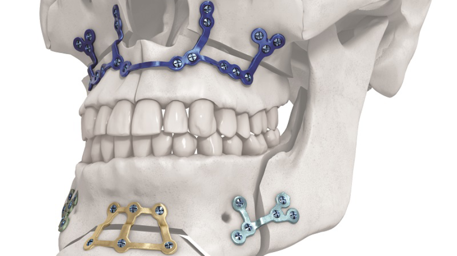 PSI Orthognathic promo