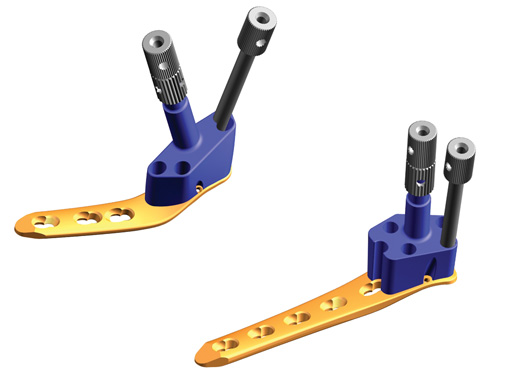 tomofix_guiding_blocks_1
