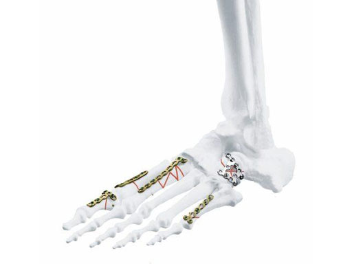 744