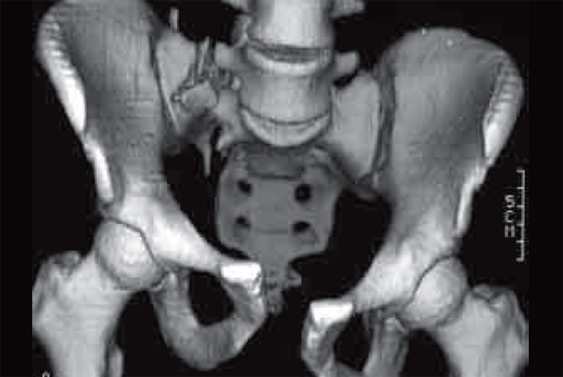 c_clamp_pic4