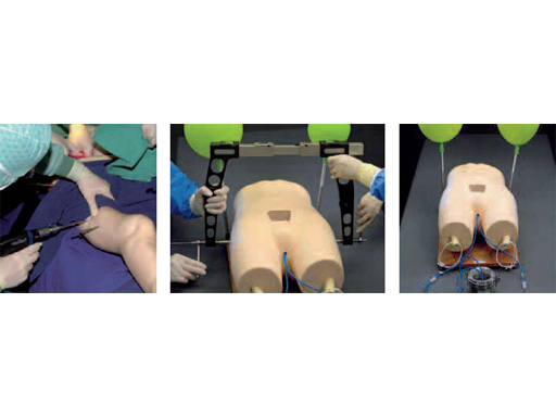 c_clamp_pic6