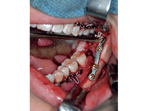 Extra_Long_Screwdriver-case