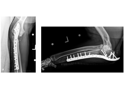 LCP_Broad_Plate_3-5_3