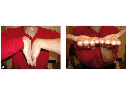 LCP_MetaDiaphyseal_Vol_DR_Plate_4