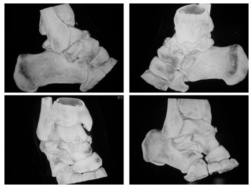 Locking_Talus_Plate_2-4_3