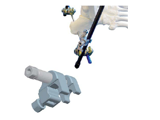 Medium_Open_Compressor_1