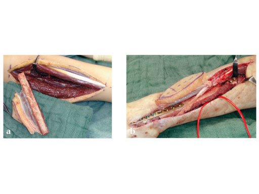 Modular_Mini_Fragment_LCP_2-1_2-4_2-7_5