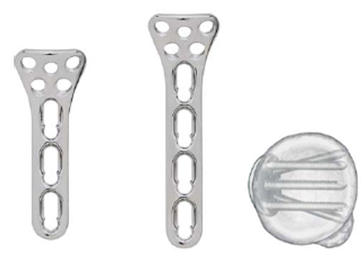 radial_head_plates_1