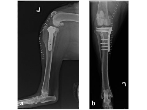 Tibia_Plateau_Leveling_Osteotomy_Plate_new_2