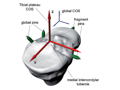 Tibia_Plateau_Leveling_Osteotomy_Plate_new_4