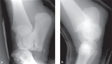 BroadLCP_5-5_Fig2ab
