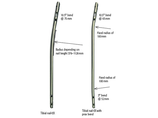 ExpertTitaniumCannulatedTibialNailwProximalBend_2