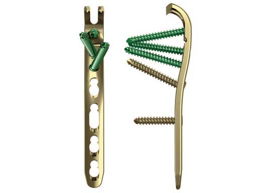 LCPDistalUlnaPlate2-0_2