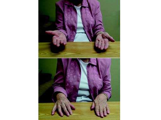 LCPWristFusionPlate_5