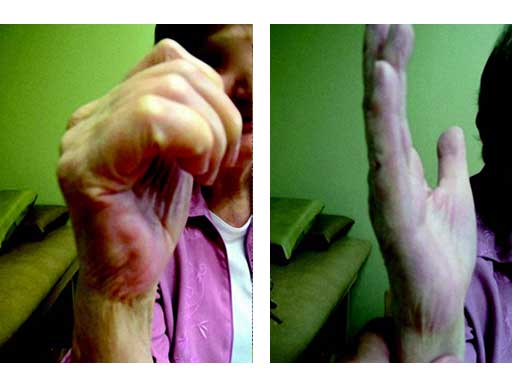 LCPWristFusionPlate_6