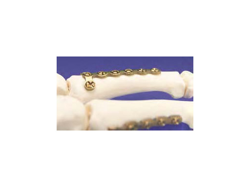 1-5mmLCPModularHandSystem_2