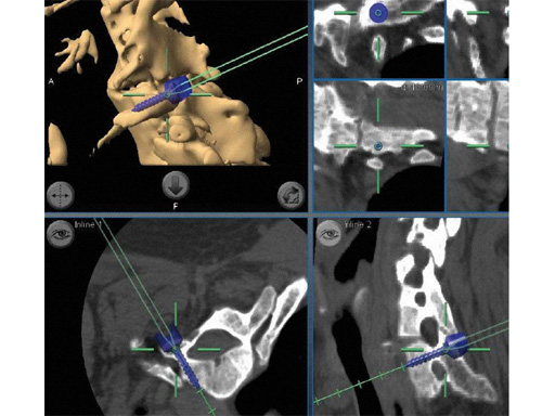 computer-ass-spinal-surgery-04