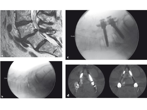 computer-ass-spinal-surgery-05