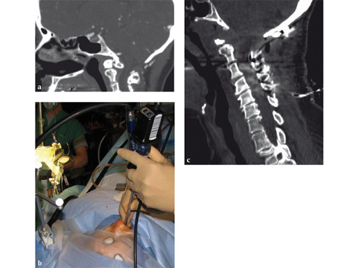 computer-ass-spinal-surgery-07