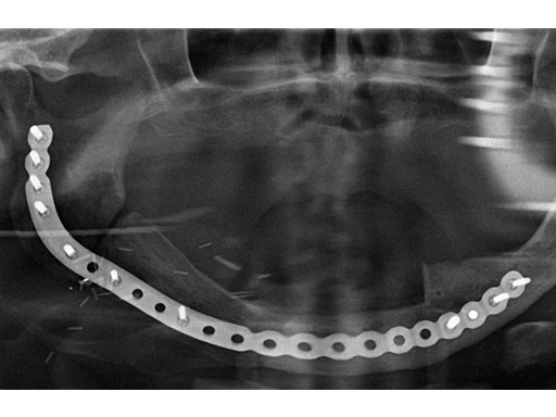 MatrixMandibleSystemPrefReconstrPlate_13