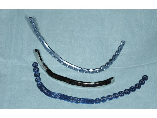 MatrixMandibleSystemPrefReconstrPlate_8