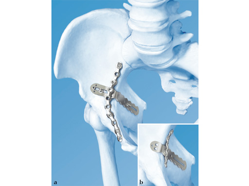 22-3-5-Quadrilateral-Surface-04