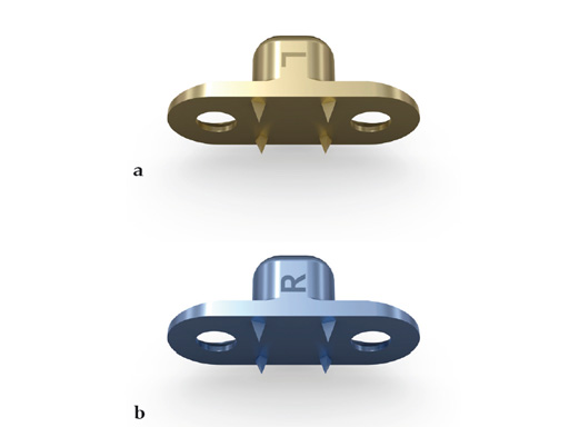 38-Transpalatal-Distractor-system-04