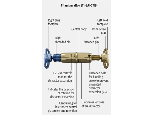 38-Transpalatal-Distractor-system-05