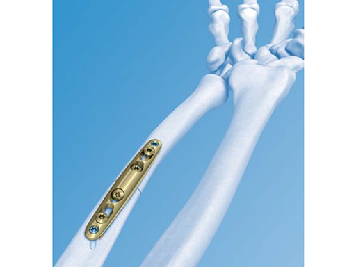 LCP-Ulna-1