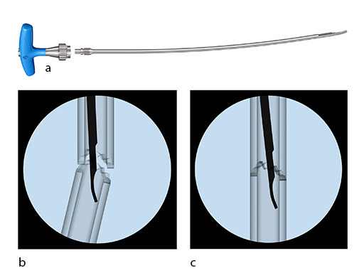Ex-Nail-Instruments-Fig-5