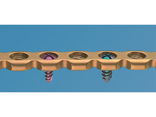 LockReconMiniPlate_fig2