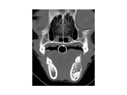 LockReconMiniPlate_fig3