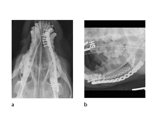 LockReconMiniPlate_fig5