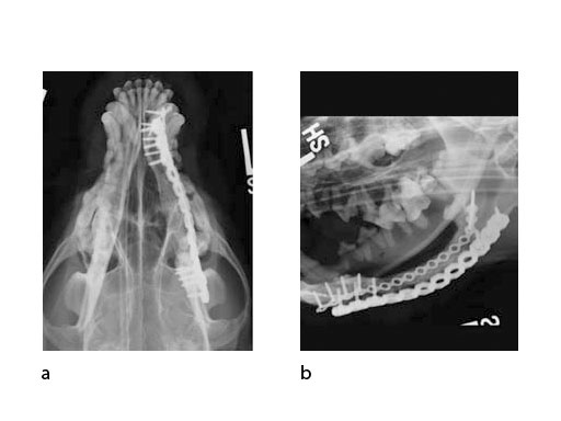 LockReconMiniPlate_fig6