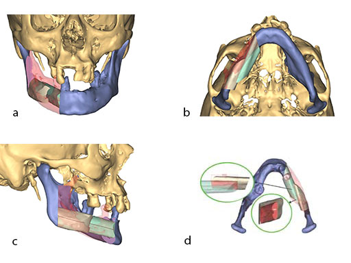 psmp-fig5