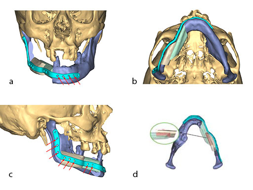 psmp-fig6