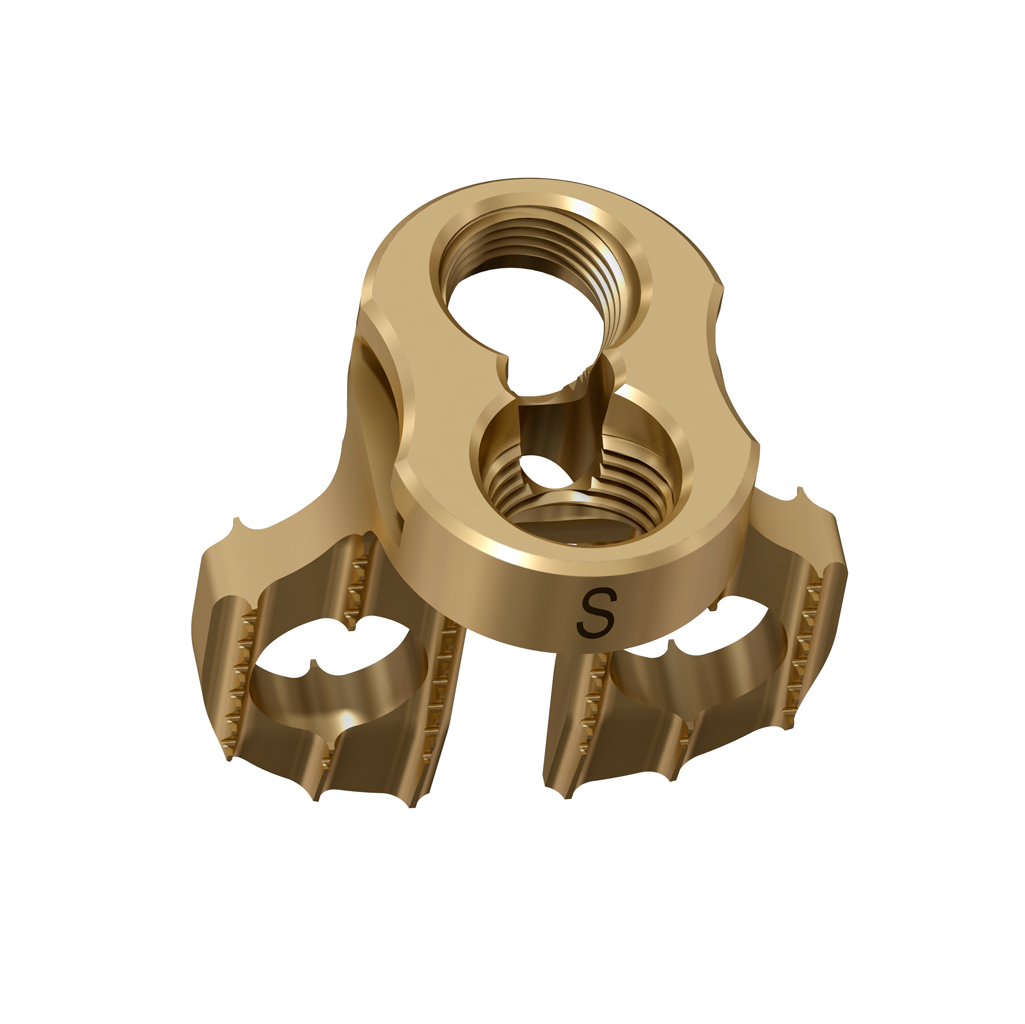 Facet Wedge Spine System
