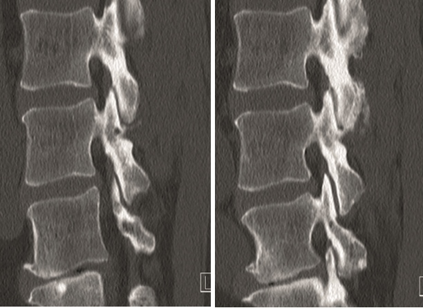 KandzioraCase1_Fig6ab