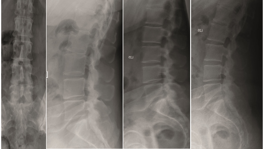 KandzioraCase2_Fig10abcd