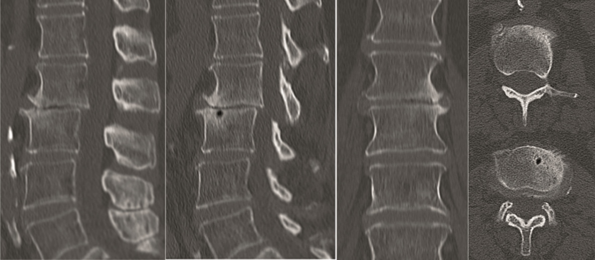KandzioraCase3_Fig13ae