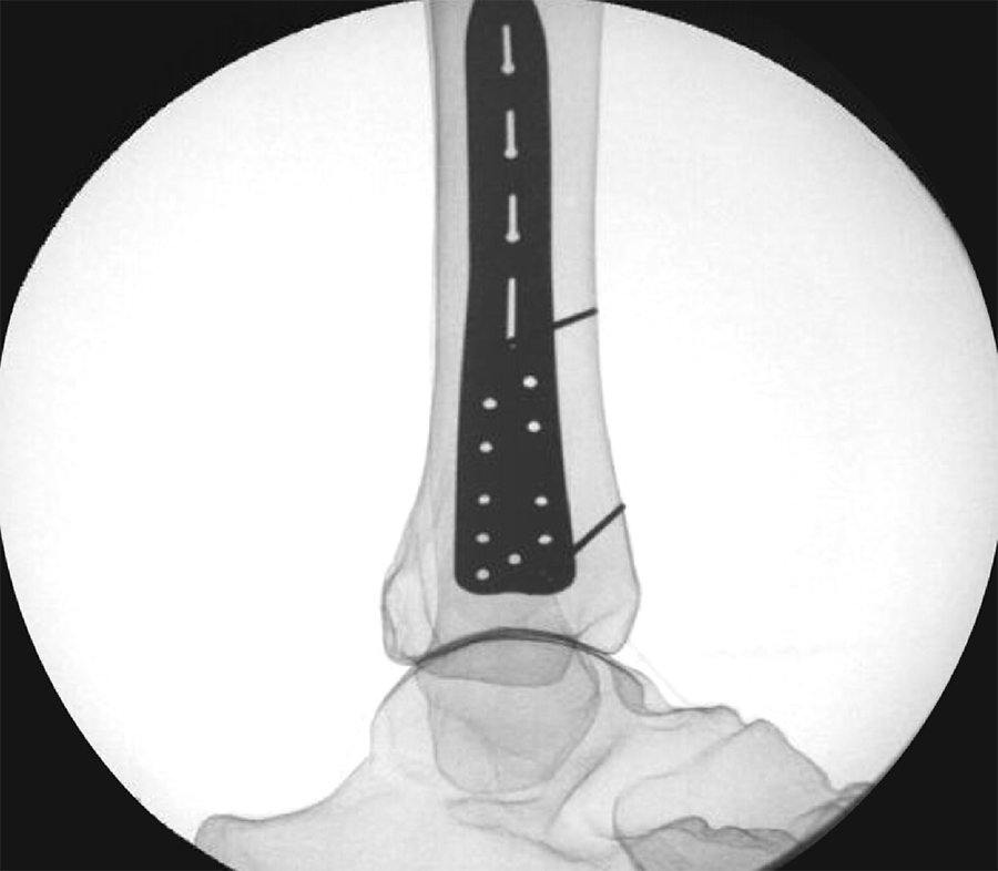FRAGMENT - FRAGMENT ×  BCPLAY Small Fragment System | JnJ Animal Health