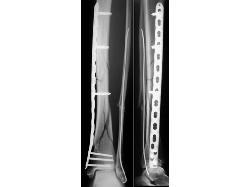 TKcdA0048d