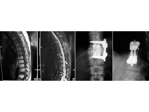 Fig.1  MRls and x-rays