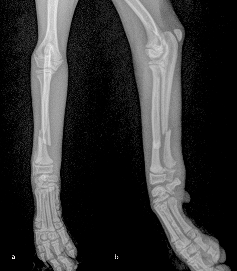 Fig-10 case 2 pre op 1