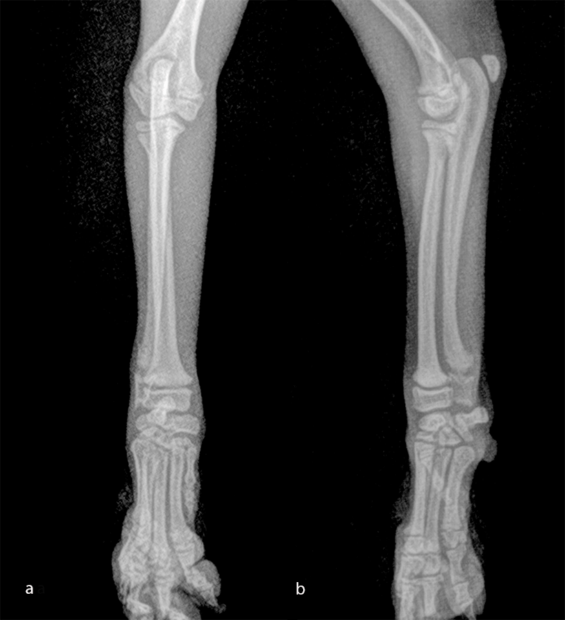 Fig-11 case 2 preop AP