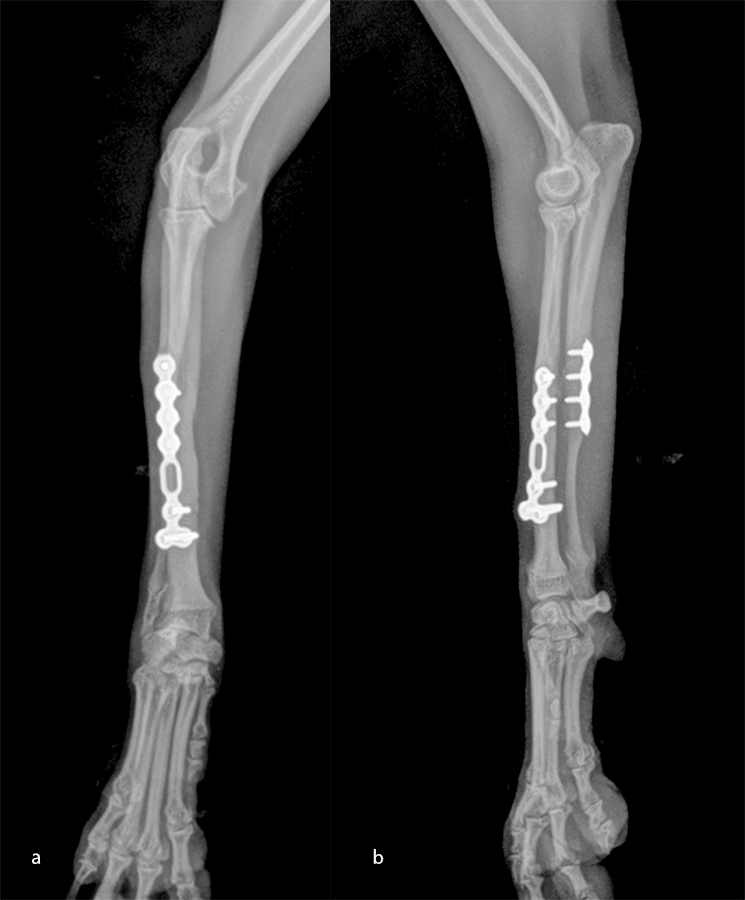 Fig-13 case 2 postop 2
