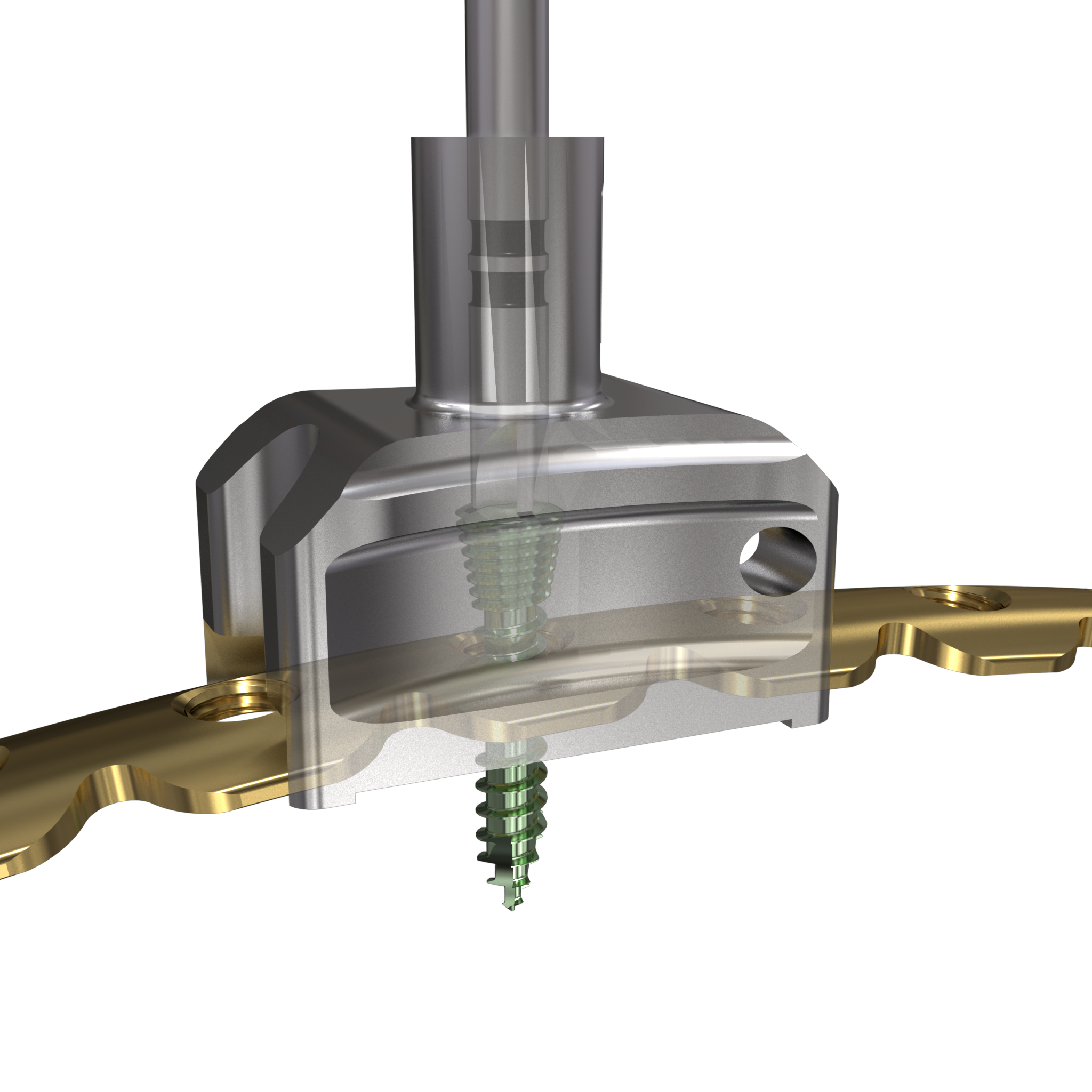 Fig 5c: Guide-plate-screw translucent